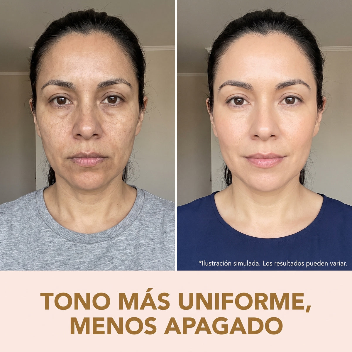 Sérum Coreano de Péptidos de Seda Sorelya™