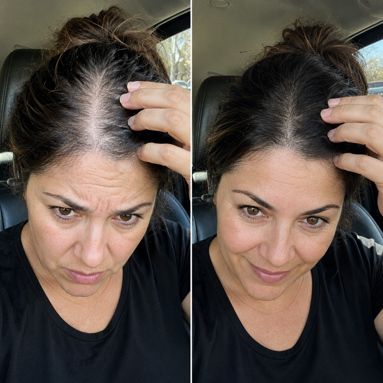 SORELYA HairBalance+